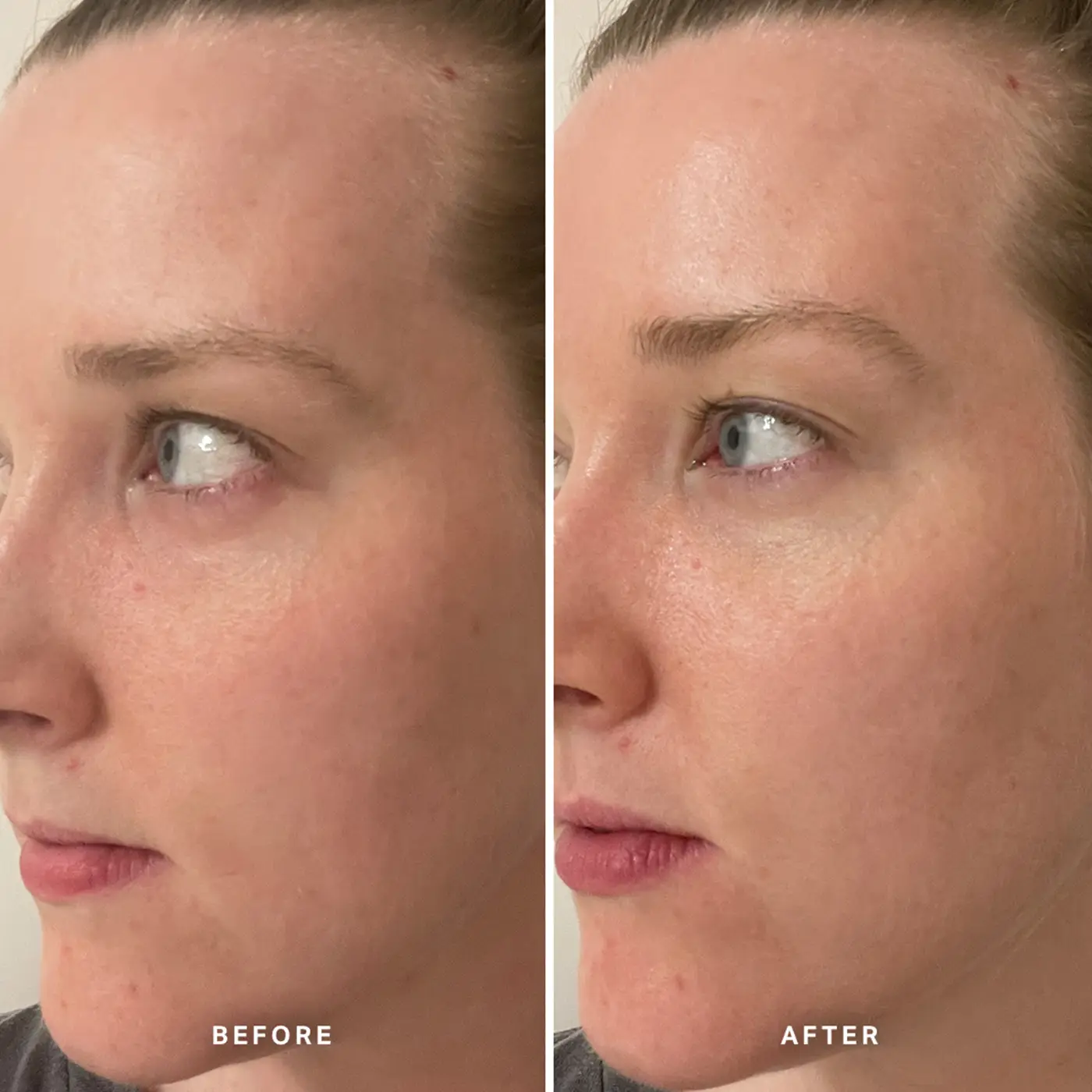 ALPHA-H - Liquid Gold Midnight Reboot Serum - Before - After