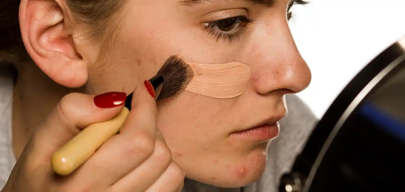 make up acne puistjes