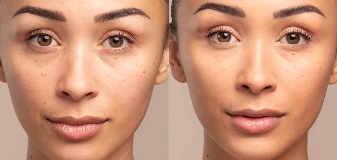 Tinted Moisturizer - Before - After