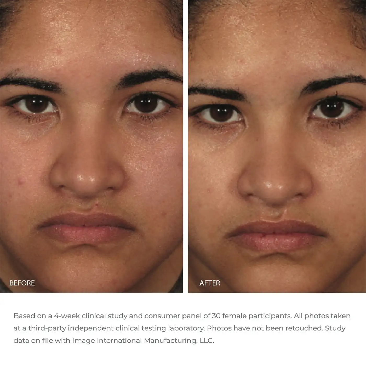Image Skincare - ORMEDIC - Balancing Gel Polisher - Before / After