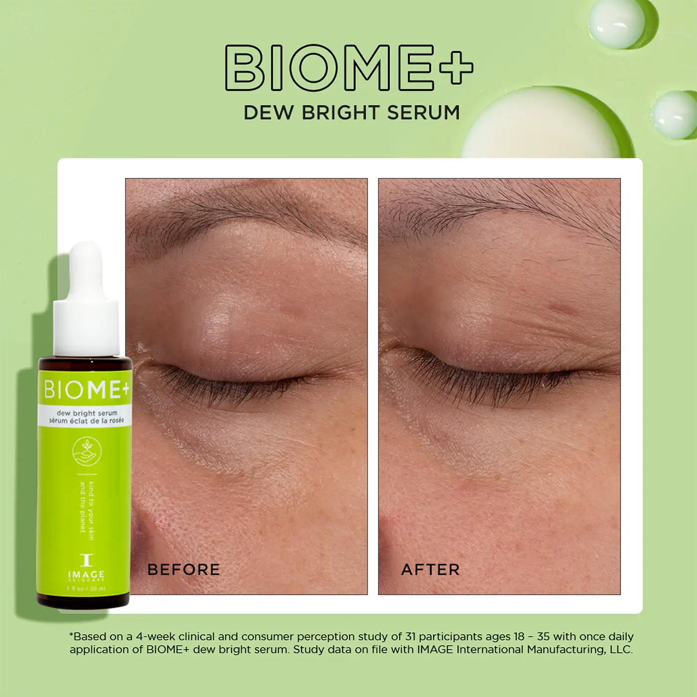 Image Skincare - BIOME- dew bright serum - Before After