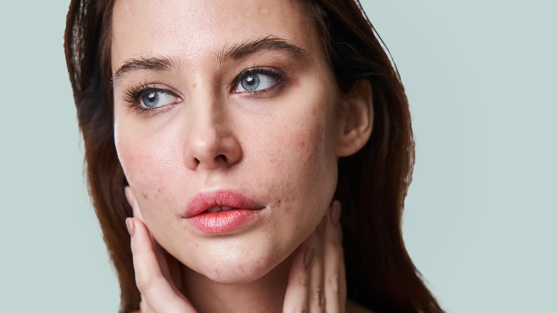 4 beste serums acne
