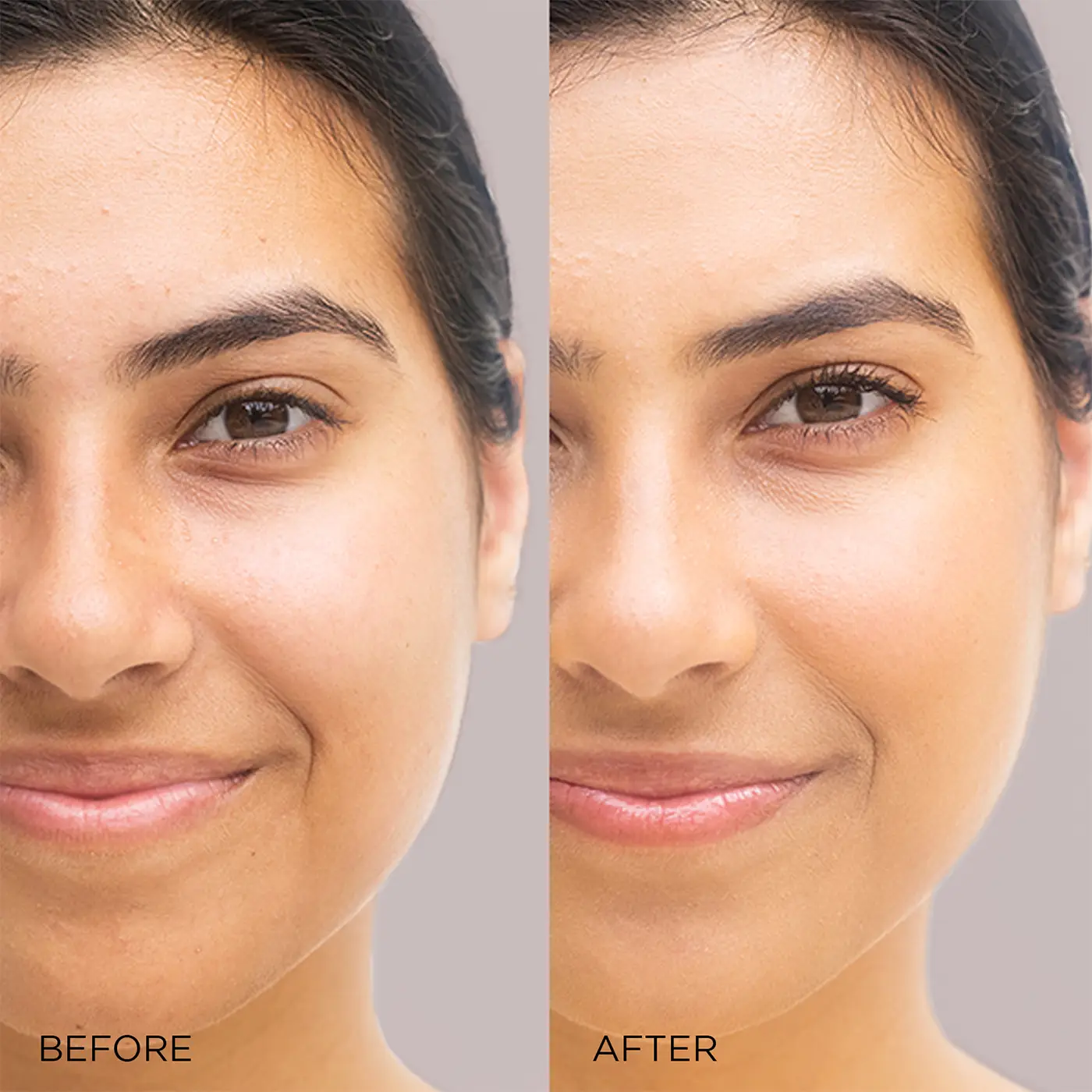 Image-Skincare - I-Beauty- I CONCEAL - flawless foundation - Beige - Before - After