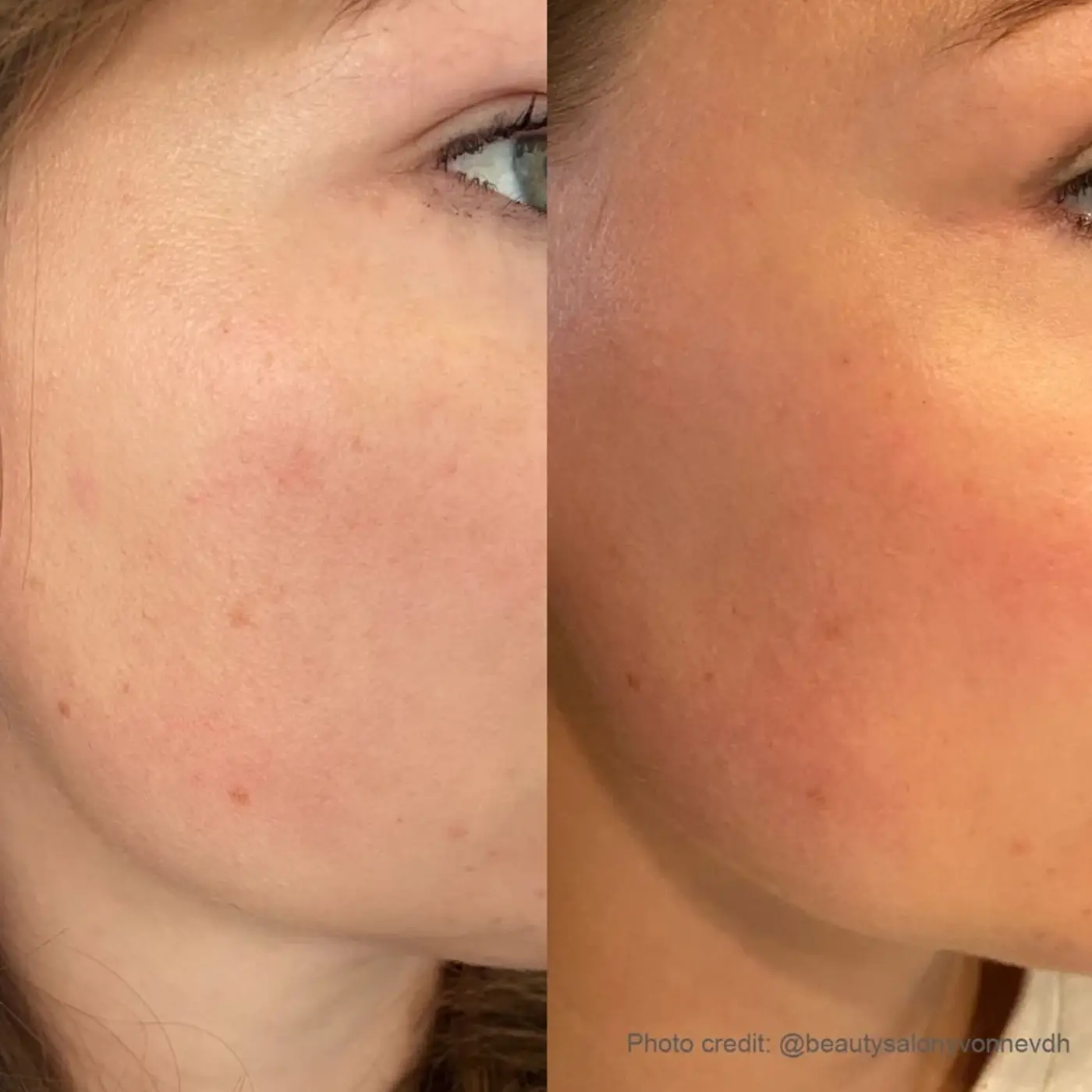SPA Salonnepro - Tanning Drops - Before After