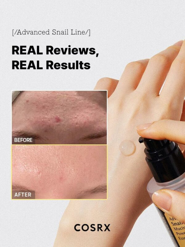 COSRX - advanced snail 96 mucin power essence - Before after