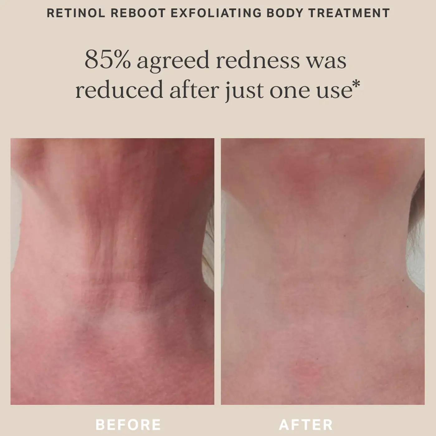 ALPHA - H - Retinol Reboot Exfoliating Body Treatment - Before / After