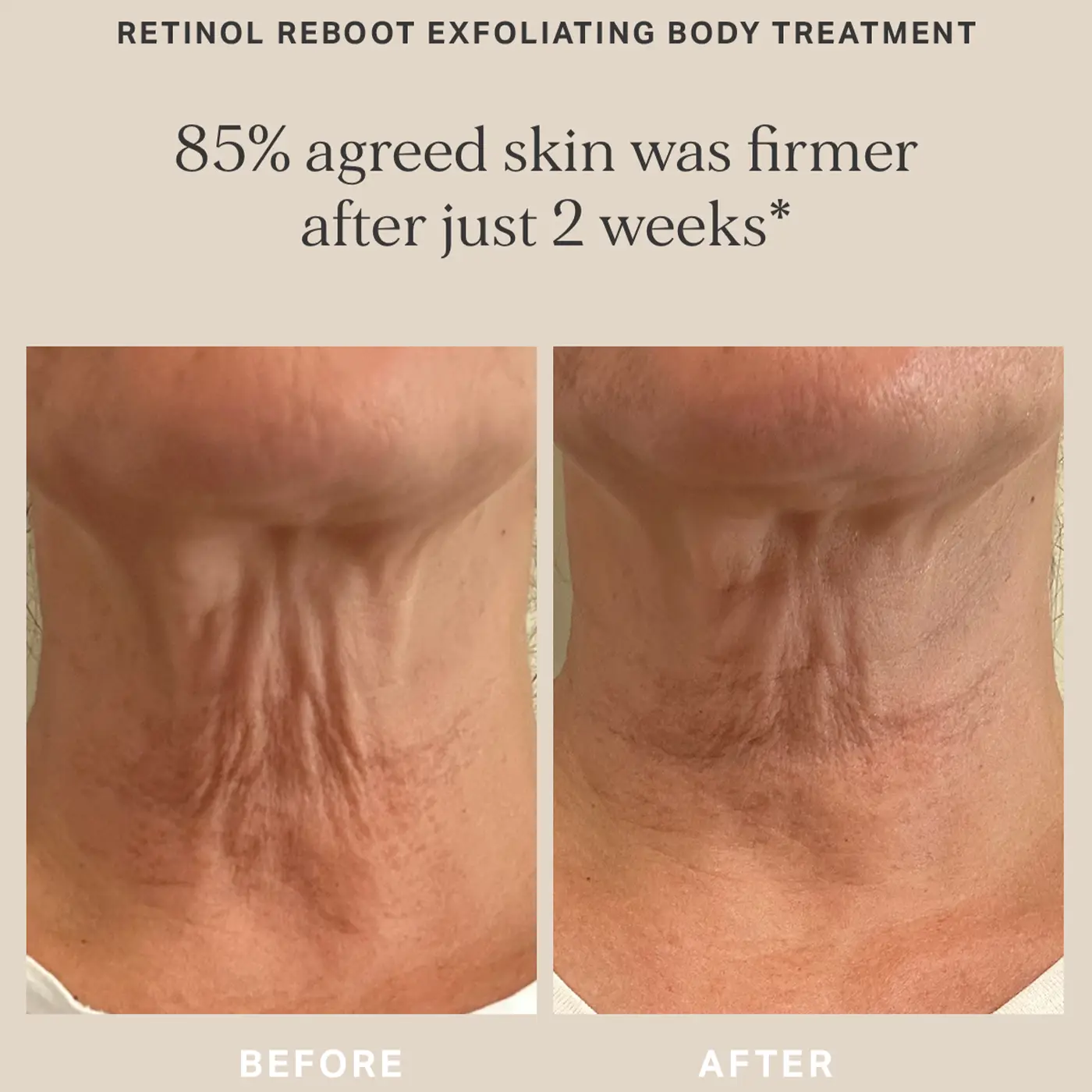 ALPHA - H - Retinol Reboot Exfoliating Body Treatment - Before - After