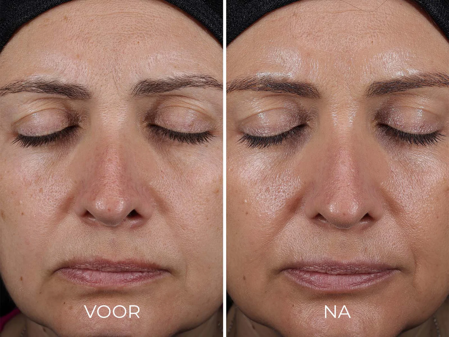 Image Skincare - Daily Prevention - Avanced Smartblend Mineral Moisturizer - SPF50 - Vergelijking