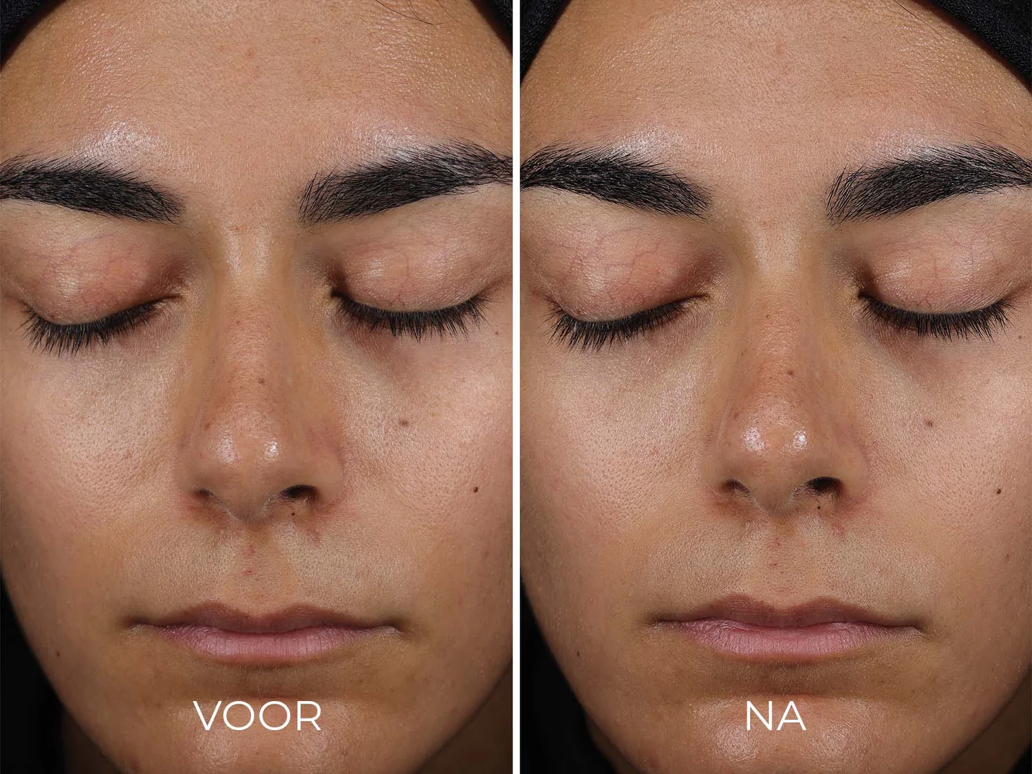 Image Skincare - Daily Prevention - Sheer Matte Moisturizer - SPF30 - Vergelijking