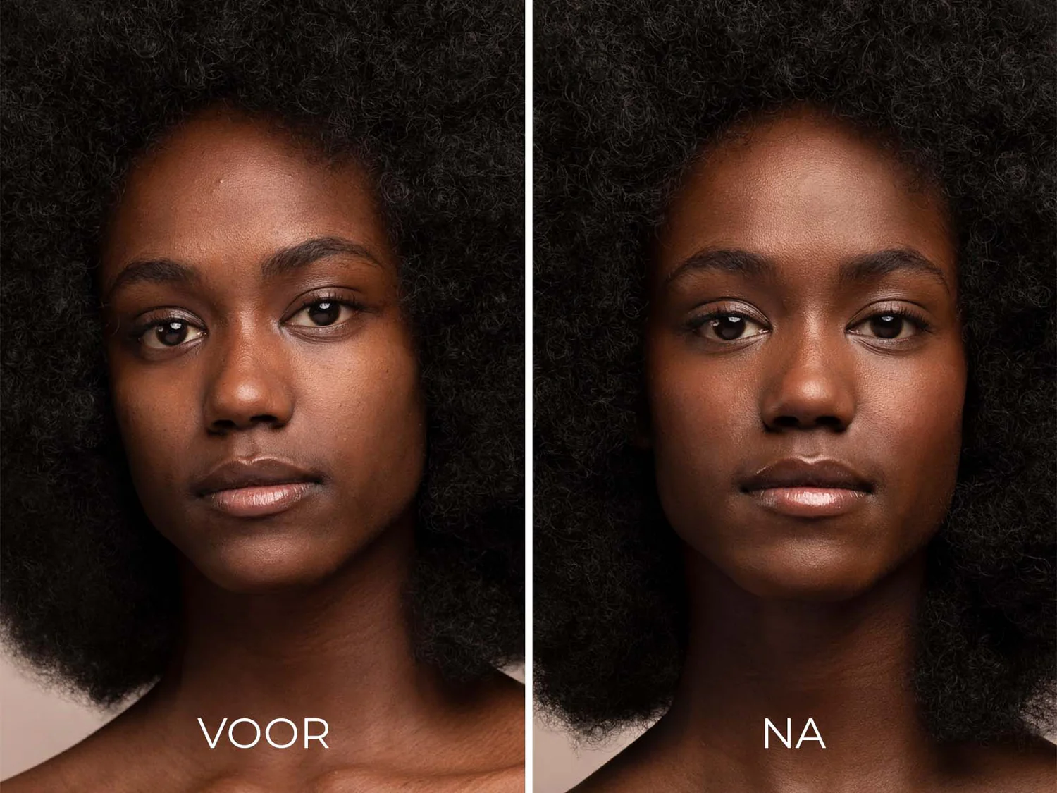 Image Skincare - Prevention - Clear Solar Gel - Vergelijking